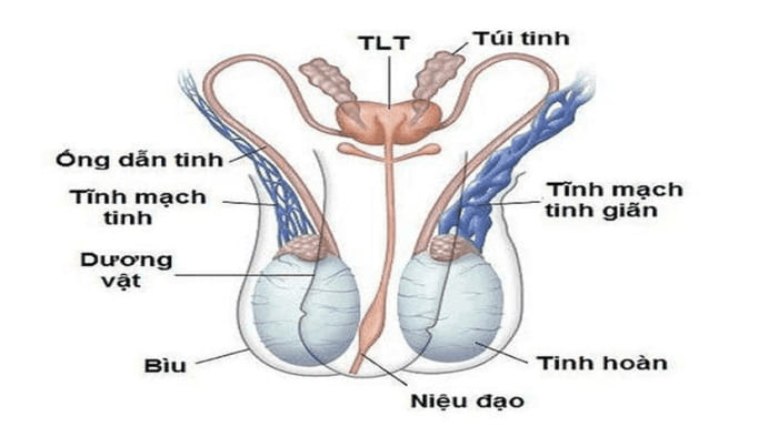 Giãn tĩnh mạch thừng tinh thường xuất hiện ở tinh hoàn bên trái